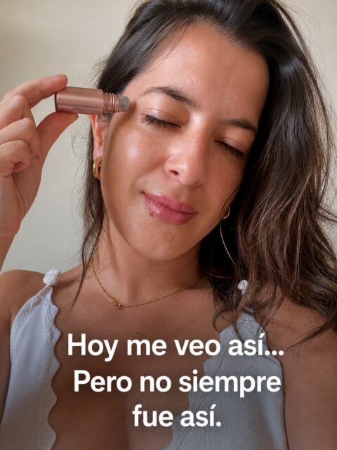 Hoy me veo así.

Pero no siempre fue así.

También tuve acné hormonal.También pasé por momentos difíciles.También hubo meses en los que dejé de cuidarme.

Mi piel reflejaba exactamente cómo me sentía.

Con el tiempo entendí que no necesitaba soluciones agresivas. Necesitaba paciencia, constancia y productos que respetaran mi piel.

Por eso elegí el skincare natural.

Porque después de cada tormenta, mi piel siempre agradece que la cuide con ingredientes puros y sin químicos agresivos.

Esta no es solo una historia de skincare.Es una historia de volver a elegirme todos los días.

¿Te identificas mi historia? Te leo en los comentarios.